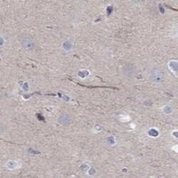 ABCG4 Rabbit anti-Human, Polyclonal, Novus Biologicals 25 &mu;g; Unconjugated:Anticuerpos