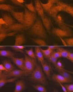 ABH1 Rabbit anti-Human, Mouse, Rat, Clone: 5K4W5, Novus Biologicals 100