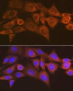 ABH1 Rabbit anti-Human, Mouse, Rat, Clone: 5K4W5, Novus Biologicals 100