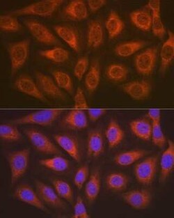 ABH1 Rabbit anti-Human, Mouse, Rat, Clone: 5K4W5, Novus Biologicals 100