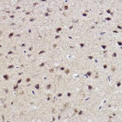 ABH1 Rabbit anti-Human, Mouse, Rat, Clone: 5K4W5, Novus Biologicals 100