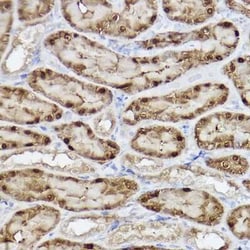 ABH1 Rabbit anti-Human, Mouse, Rat, Clone: 5K4W5, Novus Biologicals 100