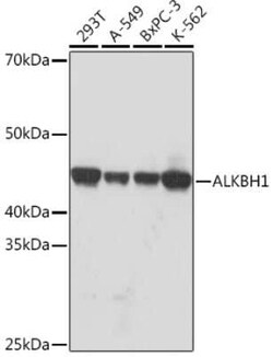 ABH1 Rabbit anti-Human, Mouse, Rat, Clone: 5K4W5, Novus Biologicals 100