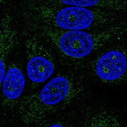 ABHD11 Antibody, Novus Biologicals:Antibodies:Primary Antibodies