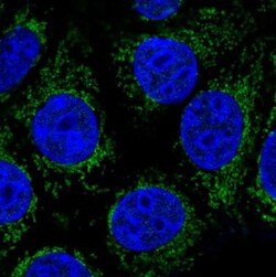 ABHD11 Antibody, Novus Biologicals 0.1mL; Unlabeled:Antibodies, Polyclonal