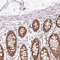 ABHD11 Antibody, Novus Biologicals 0.1mL; Unlabeled:Antibodies, Polyclonal