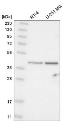 ABHD11 Antibody, Novus Biologicals:Antibodies:Primary Antibodies