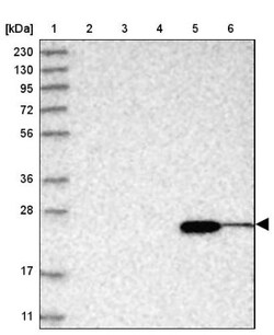 ABHD14B Antibody, Novus Biologicals:Antibodies:Primary Antibodies