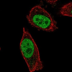 ABHD16B Antibody, Novus Biologicals 25 &mu;L, Unlabeled:Antibodies, Polyclonal