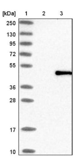 ABHD4 Antibody, Novus Biologicals 25 &mu;L | Buy Online | Novus Biologicals | Fisher Scientific