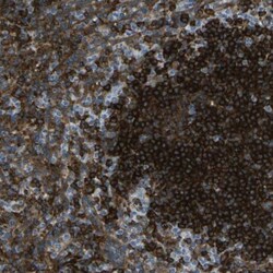 ABI3 Antibody, Novus Biologicals 0.1mL; Unlabeled:Antibodies, Polyclonal