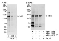 ABL2 Antibody, Novus Biologicals 0.1mL; Unlabeled:Antibodies, Polyclonal