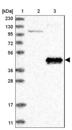 ABP1/AOC1 Antibody, Novus Biologicals 0.1mL; Unlabeled:Antibodies, Polyclonal