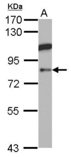 ABP1/AOC1 Antibody, Novus Biologicals 0.1mL; Unlabeled:Antibodies, Polyclonal