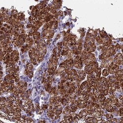 REXO5 Antibody, Novus Biologicals 0.1mL; Unlabeled:Antibodies, Polyclonal
