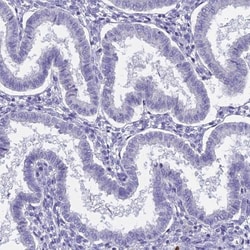 REXO5 Antibody, Novus Biologicals 0.1mL; Unlabeled:Antibodies, Polyclonal