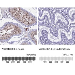 REXO5 Antibody, Novus Biologicals 0.1mL; Unlabeled:Antibodies, Polyclonal