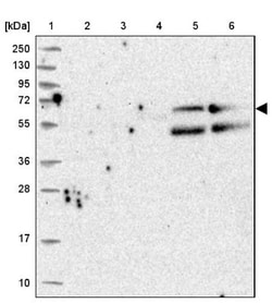 REXO5 Antibody, Novus Biologicals 0.1mL; Unlabeled:Antibodies, Polyclonal