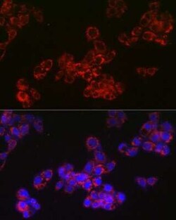 ACAA2 Rabbit anti-Human, Mouse, Rat, Clone: 8H6H5, Novus Biologicals 100