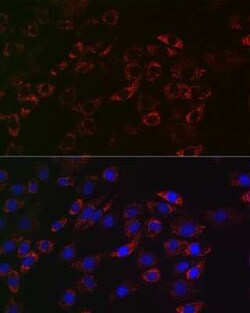 ACAA2 Rabbit anti-Human, Mouse, Rat, Clone: 8H6H5, Novus Biologicals 100