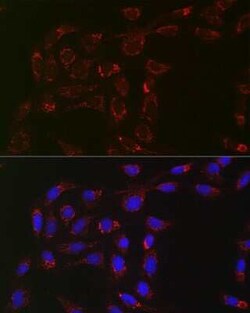 ACAA2 Rabbit anti-Human, Mouse, Rat, Clone: 8H6H5, Novus Biologicals 100