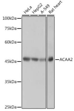 ACAA2 Rabbit anti-Human, Mouse, Rat, Clone: 8H6H5, Novus Biologicals 100