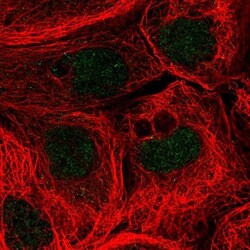 ACAD11 Antibody, Novus Biologicals:Antibodies:Primary Antibodies