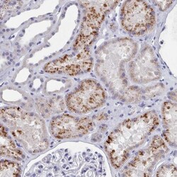 ACAD11 Antibody, Novus Biologicals:Antibodies:Primary Antibodies