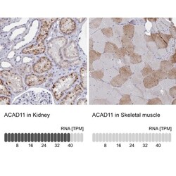 ACAD11 Antibody, Novus Biologicals:Antibodies:Primary Antibodies