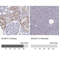 ACAD11 Antibody, Novus Biologicals:Antibodies:Primary Antibodies