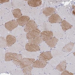 ACAD11 Antibody, Novus Biologicals:Antibodies:Primary Antibodies