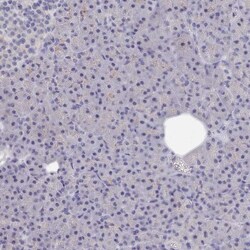 ACAD11 Antibody, Novus Biologicals:Antibodies:Primary Antibodies