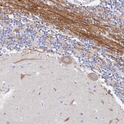 ACAD11 Antibody, Novus Biologicals:Antibodies:Primary Antibodies