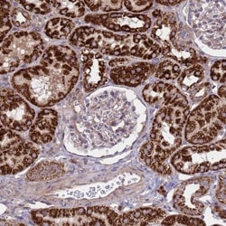 ACAD8 Antibody, Novus Biologicals 0.1mL; Unlabeled:Antibodies, Polyclonal