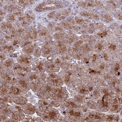 ACAD8 Antibody, Novus Biologicals 0.1mL; Unlabeled:Antibodies, Polyclonal