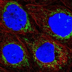 ACAD9 Antibody, Novus Biologicals:Antibodies:Primary Antibodies