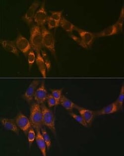 ACADM Rabbit anti-Human, Mouse, Rat, Clone: 1E5G10, Novus Biologicals:Antibodies:Primary