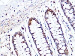 ACADM Rabbit anti-Human, Mouse, Rat, Clone: 1E5G10, Novus Biologicals:Antibodies:Primary