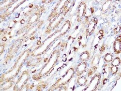 ACADM Rabbit anti-Human, Mouse, Rat, Clone: 1E5G10, Novus Biologicals:Antibodies:Primary