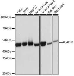 ACADM Rabbit anti-Human, Mouse, Rat, Clone: 1E5G10, Novus Biologicals:Antibodies:Primary