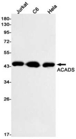 ACADS Rabbit anti-Human, Mouse, Rat, Clone: S08-4C2, Novus Biologicals