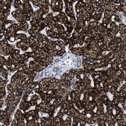 ACADS Antibody, Novus Biologicals 0.1mL; Unlabeled:Antibodies, Polyclonal