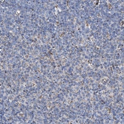 ACADS Antibody, Novus Biologicals 0.1mL; Unlabeled:Antibodies, Polyclonal