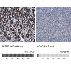ACADS Antibody, Novus Biologicals 0.1mL; Unlabeled:Antibodies, Polyclonal