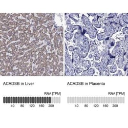 ACADSB Rabbit anti-Human, Polyclonal, Novus Biologicals 100 &mu;g; Unconjugated:Antibodies,