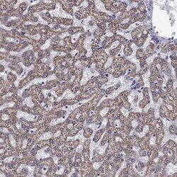 ACADSB Rabbit anti-Human, Polyclonal, Novus Biologicals 100 &mu;g; Unconjugated:Antibodies,