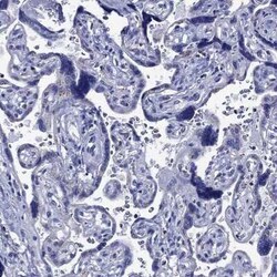 ACADSB Rabbit anti-Human, Polyclonal, Novus Biologicals 100 &mu;g; Unconjugated:Antibodies,
