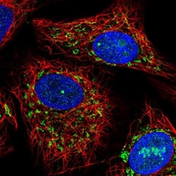 ACADVL Antibody, Novus Biologicals 0.1mL; Unlabeled:Antibodies, Polyclonal