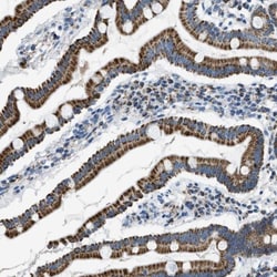 ACADVL Antibody, Novus Biologicals 0.1mL; Unlabeled:Antibodies, Polyclonal