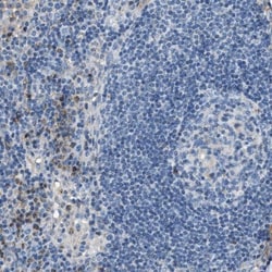 ACADVL Antibody, Novus Biologicals 0.1mL; Unlabeled:Antibodies, Polyclonal